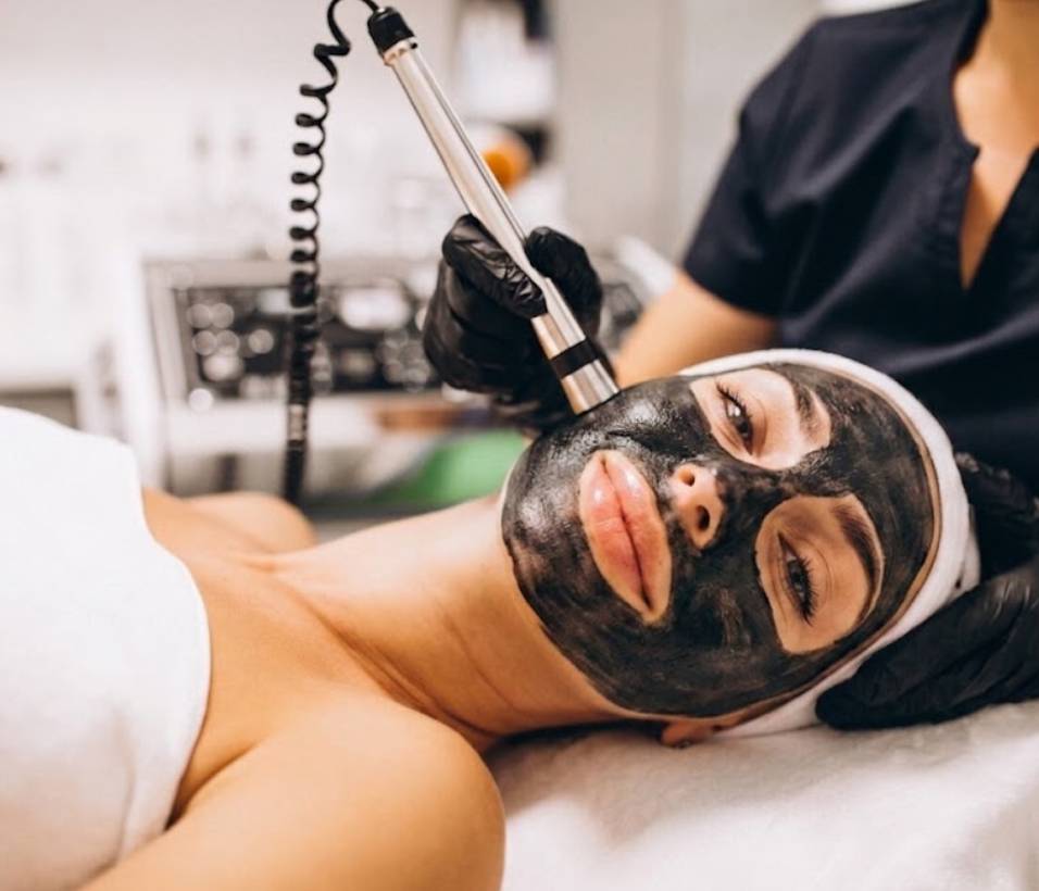 Laser Treatment carbon laser