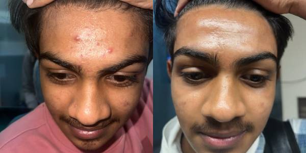 face after before