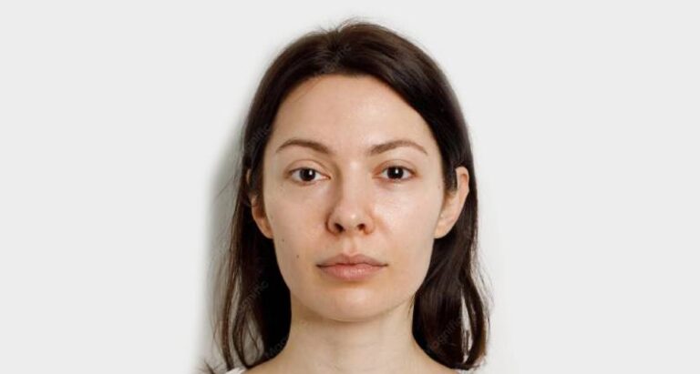 face before photo 02