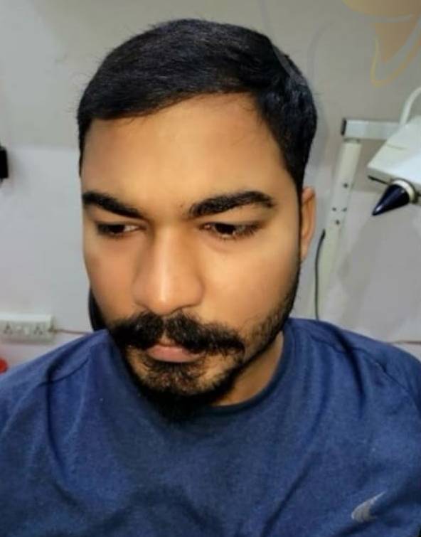 hair treatment after