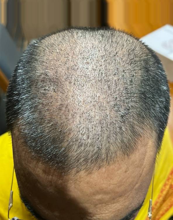 hair treatment after