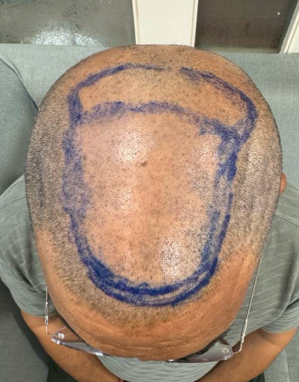 hair treatment before