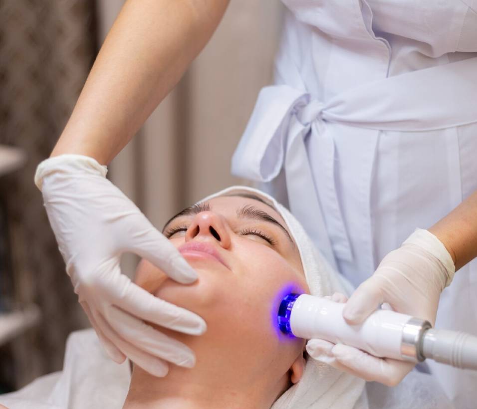 photofacial